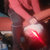 bblungs thumbnail